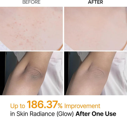Peel Shot Kojic Acid + Turmeric Exfoliating Spray