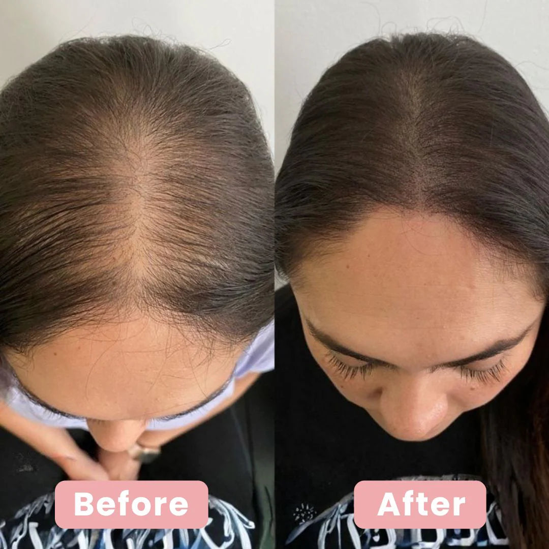 4-in-1 Haar-Therapie-Bürste