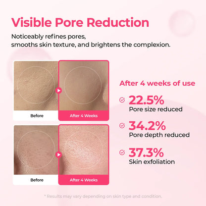 Duo Coreen Eclat Pores et Taches Sombres