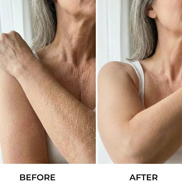 Serum Corps Raffermissant a l'HA pour Peau Relachee