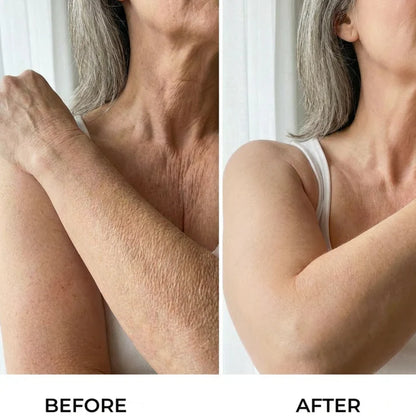 Serum Corps Raffermissant a l'HA pour Peau Relachee
