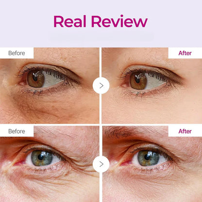 Patchs Yeux Anti-Rides au Collagene et Calcium