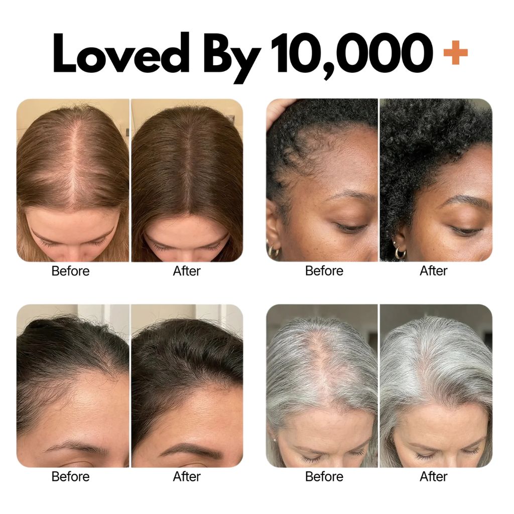 Lindalia Korean Scalp & Hair Growth Serum, loved by thousands, before and after