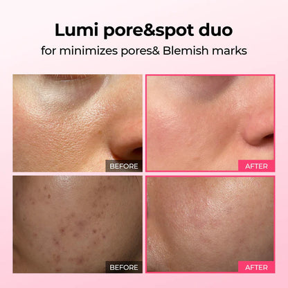 Duo Coreen Eclat Pores et Taches Sombres