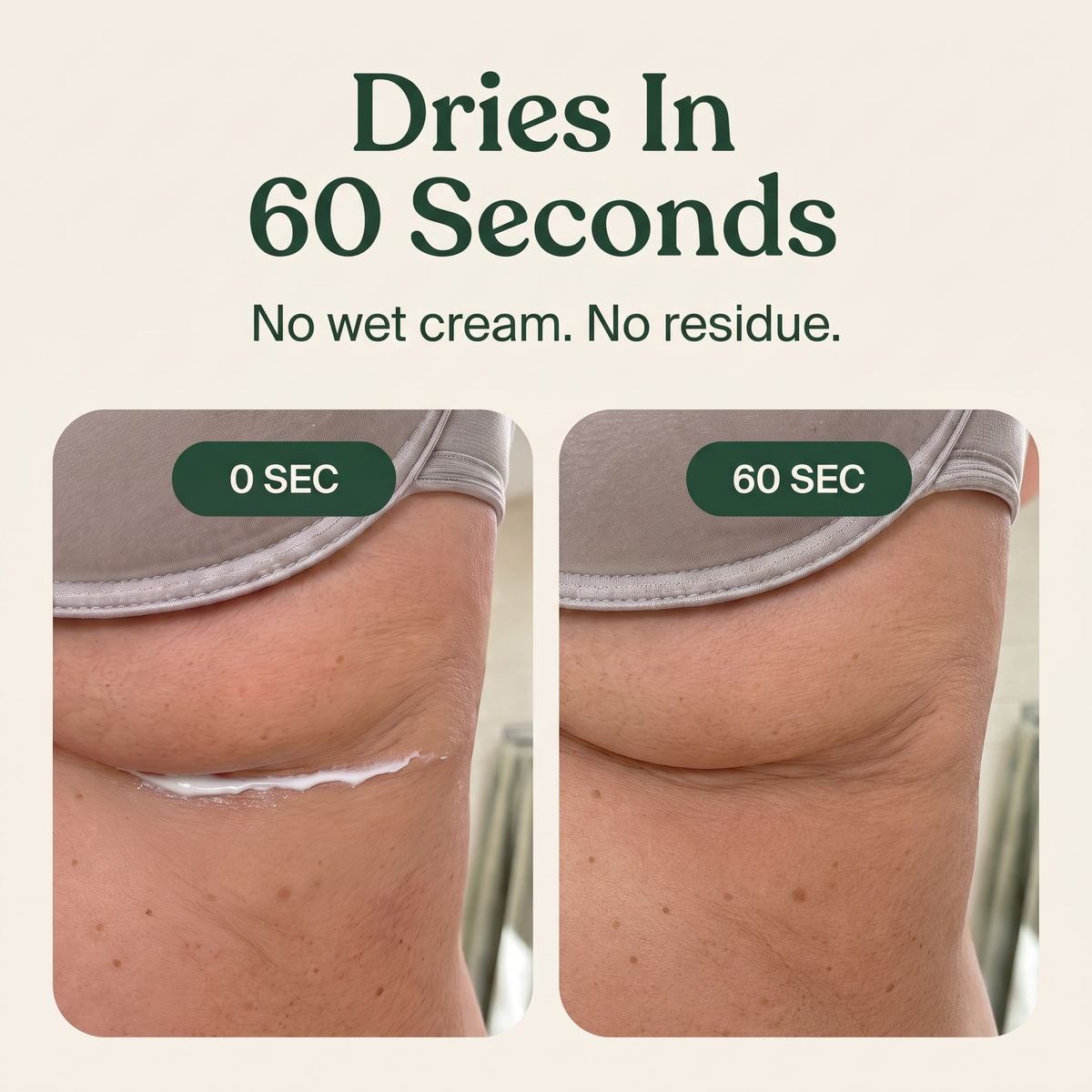 Lindalia Fold Rash Relief Cream