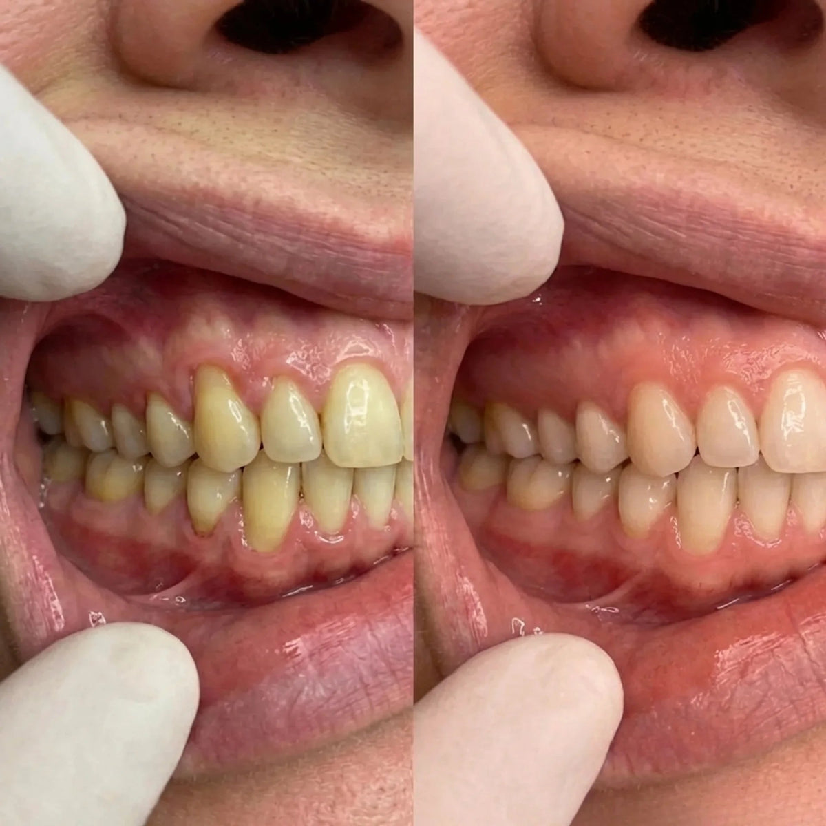 Lindalia CollaGum Gum Rebuild Collagen Powder